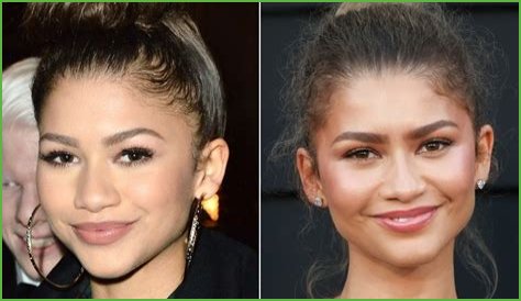 Unveiling The Truth: Zendaya's Plastic Surgery Journey